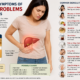 Liver Problem Symptoms in Females
